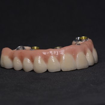 https://american-dental-arts.com/wp-content/uploads/2023/11/prosthesis.jpg