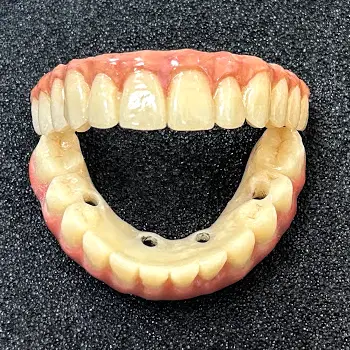https://american-dental-arts.com/wp-content/uploads/2025/08/Conventional-Complete-Dentures.webp