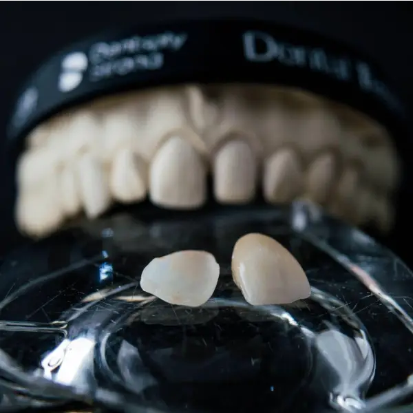 https://american-dental-arts.com/wp-content/uploads/2025/08/Conventional-Temporary-Crowns.webp