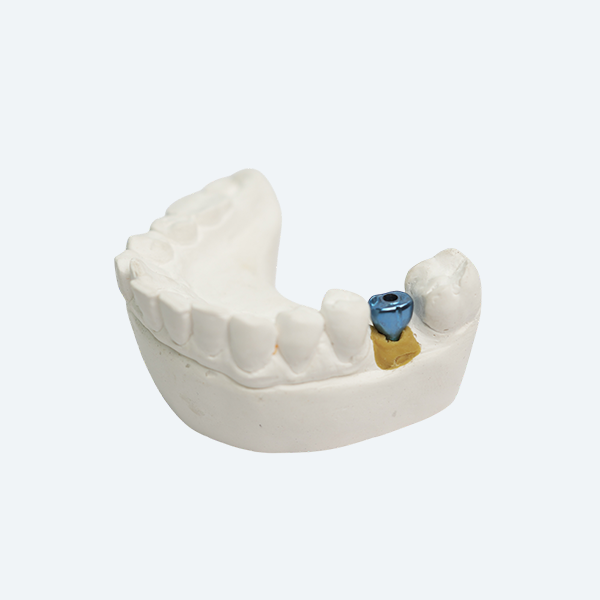 https://american-dental-arts.com/wp-content/uploads/2025/08/IMG-Abutment.webp