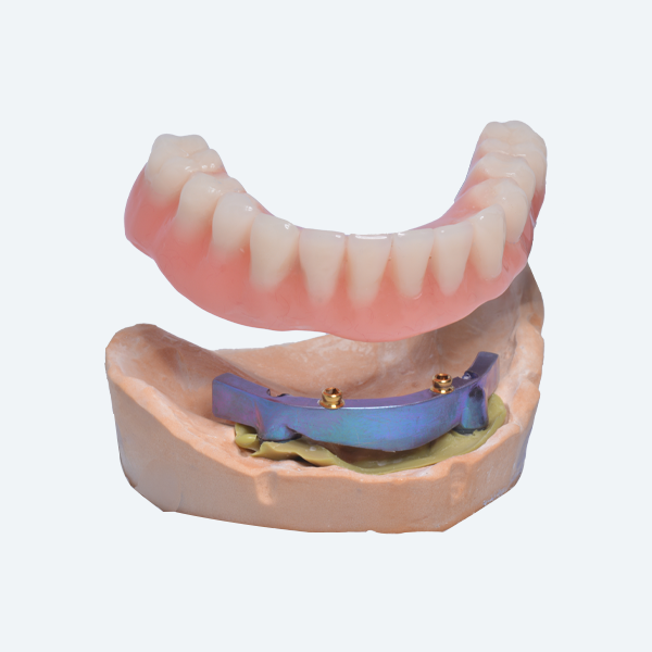 https://american-dental-arts.com/wp-content/uploads/2025/08/Implant-Supported-Removable-Dentures-v2.webp